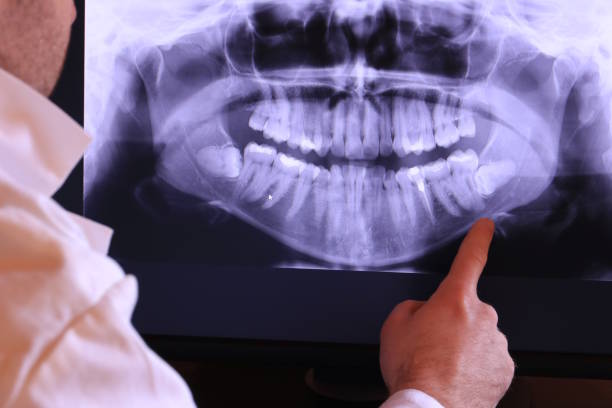 Best Emergency Root Canal Treatment in Horatio, AR